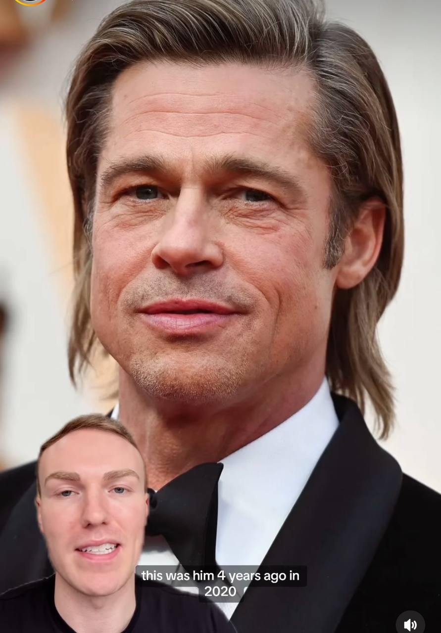 60-річний Бред Пітт зробив пластику обличчя: який вигляд зараз має актор (відео)